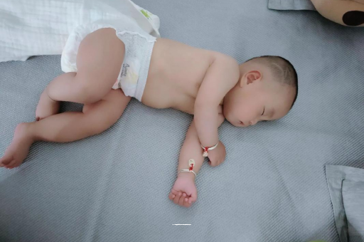 老河口宝宝头上长痱子